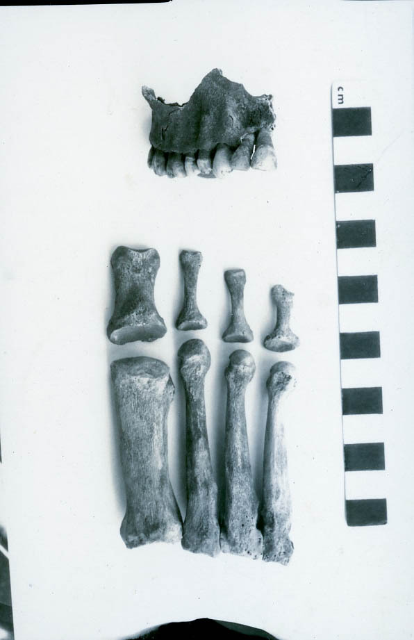 Human Skull with toe bones